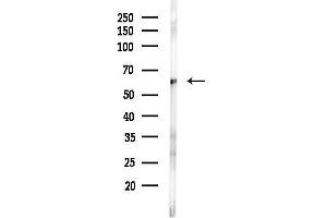 anti-Inositol-3-Phosphate Synthase 1 (ISYNA1) (C-Term) antibody