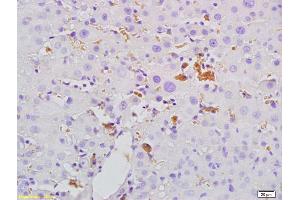 Formalin-fixed and paraffin embedded rat liver tissue labeled with Anti- Mannan Binding Lectin Polyclonal Antibody, Unconjugated (ABIN731663) at 1:200, followed by conjugation to the secondary antibody and DAB staining. (MBP/MBL Antikörper  (AA 31-130))