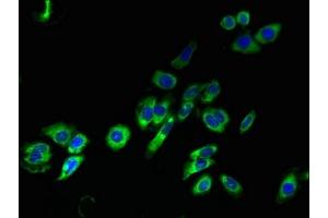 Immunofluorescent analysis of HepG2 cells using ABIN7172926 at dilution of 1:100 and Alexa Fluor 488-congugated AffiniPure Goat Anti-Rabbit IgG(H+L) (TM4SF1 Antikörper  (AA 115-161))