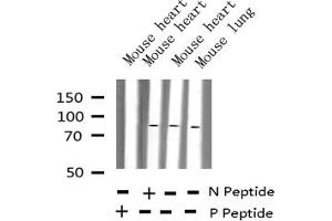 Western Blotting (WB) image for anti-Heat Shock Factor Protein 1 (HSF1) (pSer303) antibody (ABIN6256259)
