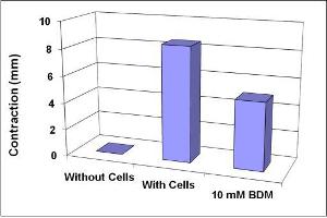 Contraction inhibition by BDM. (CytoSelect™ 24-Well Cell Contraction Assay Kit (Floating Matrix Model))