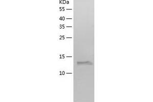 Western Blotting (WB) image for Acid Phosphatase 1, Soluble (ACP1) (AA 1-158) protein (His-IF2DI Tag) (ABIN7121648)