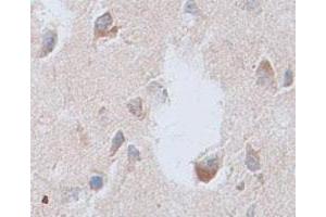 Immunohistochemical staining of formalin-fixed paraffin-embedded human brain tissue showing membrane staining with CNTFR polyclonal antibody  at 1 : 100 dilution. (CNTF Receptor alpha Antikörper  (Internal Region))