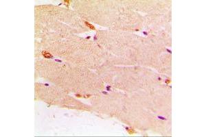 Immunohistochemical analysis of Desmin staining in human muscle formalin fixed paraffin embedded tissue section. (Desmin Antikörper  (C-Term))