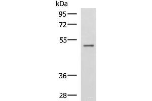 Western blot analysis of Human placenta tissue lysate using GRWD1 Polyclonal Antibody at dilution of 1:800 (GRWD1 Antikörper)