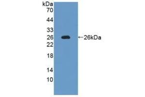 Detection of Recombinant IL12A, Rat using Polyclonal Antibody to Interleukin 12A (IL12A) (IL12A Antikörper  (AA 23-215))