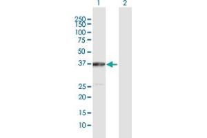 Western Blot analysis of ACAT2 expression in transfected 293T cell line by ACAT2 MaxPab polyclonal antibody. (ACAT2 Antikörper  (AA 1-397))