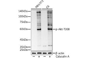 Western blot analysis of extracts of various cell lines, using Phospho-Akt-T308 antibody (ABIN7271240) at 1:1000 dilution. (AKT1 Antikörper  (pThr308))