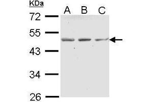 WB Image Sample (30 ug of whole cell lysate) A: A431 , B: H1299 C: Hela 10% SDS PAGE antibody diluted at 1:1000 (ENTPD5 Antikörper  (Center))
