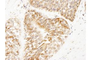 Immunohistochemistry (IHC) image for anti-A Kinase (PRKA) Anchor Protein 1 (AKAP1) (AA 375-425) antibody (ABIN7448928) (AKAP1 Antikörper  (AA 375-425))