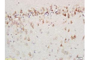 Formalin-fixed and paraffin embedded labeled with rat brain Anti-AMBRA1 Polyclonal Antibody, Unconjugated 1:200 followed by conjugation to the secondary antibody and DAB staining (AMBRA1 Antikörper  (AA 221-320))