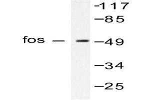 Image no. 1 for anti-c-Fos (c-Fos) antibody (ABIN265423) (c-FOS Antikörper)