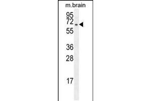 Western blot analysis in mouse brain tissue lysates (35ug/lane). (FBXO21 Antikörper  (C-Term))