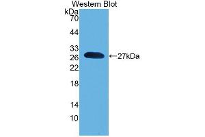 Western blot analysis of the recombinant protein. (Pronociceptin (AA 12-181) Antikörper)