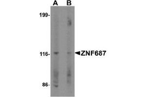 Western blot analysis of ZNF687 in Jurkat cell lysate with ZNF687 Antibody  at 0. (ZNF687 Antikörper  (C-Term))