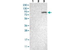 Western Blot (Cell lysate) analysis with ELMO2 polyclonal antibody  Lane 1: Human cell line RT-4 Lane 2: Human cell line U-251MG sp Lane 3: Human plasma (IgG/HSA depleted)