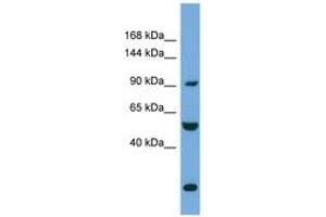 Image no. 1 for anti-Exocyst Complex Component 1 (EXOC1) (AA 35-84) antibody (ABIN6745695) (EXOC1 Antikörper  (AA 35-84))