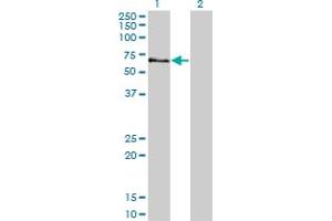 Western Blot analysis of STK3 expression in transfected 293T cell line by STK3 monoclonal antibody (M13), clone 4F7. (STK3 Antikörper  (AA 311-431))