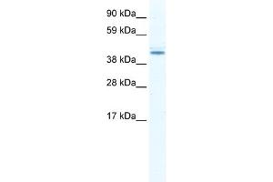 WB Suggested Anti-DDX49 Antibody Titration:  2. (DDX49 Antikörper  (N-Term))