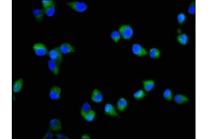 Immunofluorescence staining of SH-SY5Y cells with ABIN7170569 at 1:200, counter-stained with DAPI. (S1PR2 Antikörper  (AA 293-353))