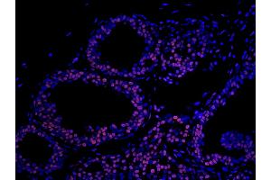 Immunofluorescence (IF) image for anti-Matrin 3 (MATR3) (C-Term) antibody (ABIN7448986)