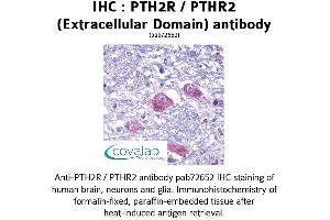 Image no. 1 for anti-Parathyroid Hormone 2 Receptor (PTH2R) (1st Extracellular Domain), (pThr2) antibody (ABIN1738582) (PTH2R Antikörper  (1st Extracellular Domain, pThr2))