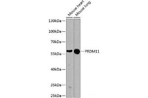 Western blot analysis of extracts of various cell lines using PRDM11 Polyclonal Antibody at dilution of 1:1000. (PRDM11 Antikörper)