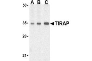 Western blot analysis of TIRAP in human heart cell lysates with this product at (A) 0.