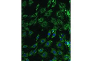 Immunofluorescence analysis of C6 cells using Galectin 3/Galectin 3/LG antibody (ABIN6130437, ABIN6143158, ABIN6143159 and ABIN7101422) at dilution of 1:100. (Galectin 3 Antikörper  (AA 1-250))