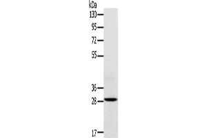 Western Blotting (WB) image for anti-Triggering Receptor Expressed On Myeloid Cells 2 (TREM2) antibody (ABIN2434061) (TREM2 Antikörper)