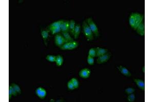 Immunofluorescent analysis of HepG2 cells using ABIN7160542 at dilution of 1:100 and Alexa Fluor 488-congugated AffiniPure Goat Anti-Rabbit IgG(H+L) (MYL6 Antikörper  (AA 3-151))