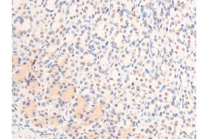 ABIN6267305 at 1/100 staining rat gastric tissue sections by IHC-P. (C-JUN Antikörper  (pThr239))