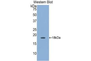 Western blot analysis of the recombinant protein. (Angiopoietin 2 Antikörper  (AA 24-165))