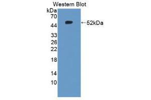 Western blot analysis of the recombinant protein. (TNC Antikörper  (AA 174-621))