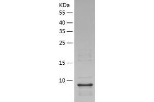 Western Blotting (WB) image for Aquaporin 4 (AQP4) (AA 253-323) protein (His tag) (ABIN7286505) (Aquaporin 4 Protein (AQP4) (AA 253-323) (His tag))