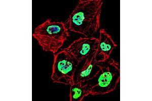 Fluorescent confocal image of Hela cell stained with HNRNPD Antibody (N-term).