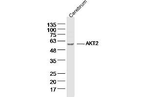 Mouse Cerebrum lysates probed with AKT2 Polyclonal Antibody, unconjugated  at 1:300 overnight at 4°C followed by a conjugated secondary antibody for 60 minutes at 37°C. (AKT2 Antikörper  (AA 101-200))