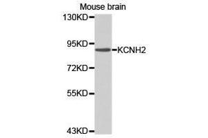 Western Blotting (WB) image for anti-Potassium Voltage-Gated Channel, Subfamily H (Eag-Related), Member 2 (KCNH2) antibody (ABIN1873378) (KCNH2 Antikörper)