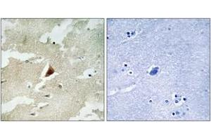 Immunohistochemistry analysis of paraffin-embedded human brain tissue, using MAPKAPK5 Antibody. (MAPKAP Kinase 5 Antikörper  (AA 171-220))