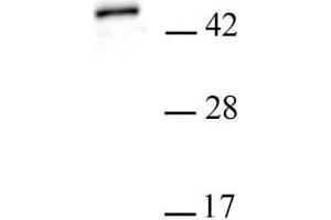 PHF6 antibody (pAb) tested by Western blot. (PHF6 Antikörper  (Isoform 1, N-Term))