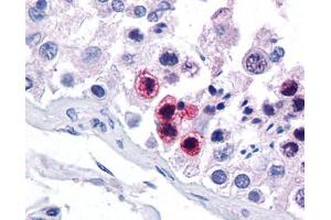 Immunohistochemistry (IHC) image for anti-RAR-Related Orphan Receptor C (RORC) (N-Term) antibody (ABIN2787955) (RORC Antikörper  (N-Term))