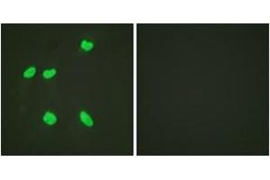Immunofluorescence analysis of HeLa cells, using Histone H4 (Acetyl-Lys16) Antibody.