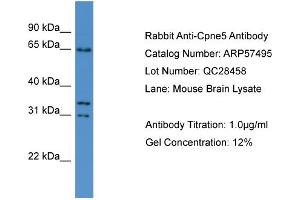 WB Suggested Anti-Cpne5  Antibody Titration: 0. (Copine V Antikörper  (N-Term))