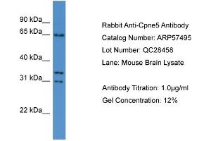 WB Suggested Anti-Cpne5  Antibody Titration: 0.