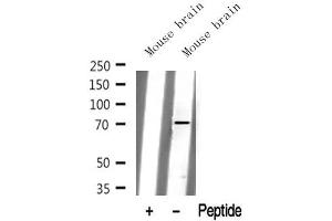 Western Blotting (WB) image for anti-Potassium Voltage-Gated Channel, Shaw-Related Subfamily, Member 4 (KCNC4) (N-Term) antibody (ABIN6262897)
