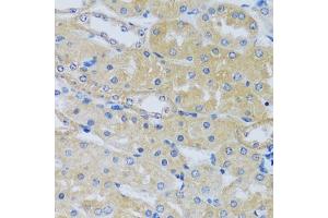 Immunohistochemistry of paraffin-embedded mouse kidney using C antibody (ABIN6129635, ABIN6137807, ABIN6137808 and ABIN6217796) at dilution of 1:100 (40x lens). (CABP7 Antikörper  (AA 100-180))