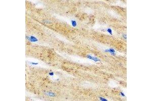Immunohistochemical analysis of IL-18BP staining in mouse heart formalin fixed paraffin embedded tissue section. (IL18BP Antikörper)