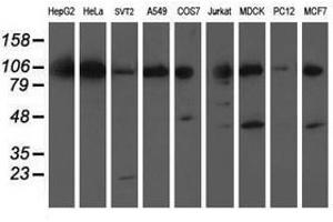 Image no. 2 for anti-Excision Repair Cross-Complementing Rodent Repair Deficiency, Complementation Group 4 (ERCC4) antibody (ABIN1498073) (ERCC4 Antikörper)