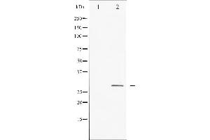 Western blot analysis of HSP27 expression in Ca2+ treated HeLa whole cell lysates,The lane on the left is treated with the antigen-specific peptide. (HSP27 Antikörper  (Internal Region))