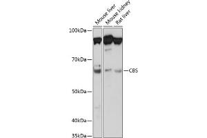 Western blot analysis of extracts of various cell lines, using CBS Rabbit mAb (ABIN7266615) at 1:1000 dilution. (CBS Antikörper)